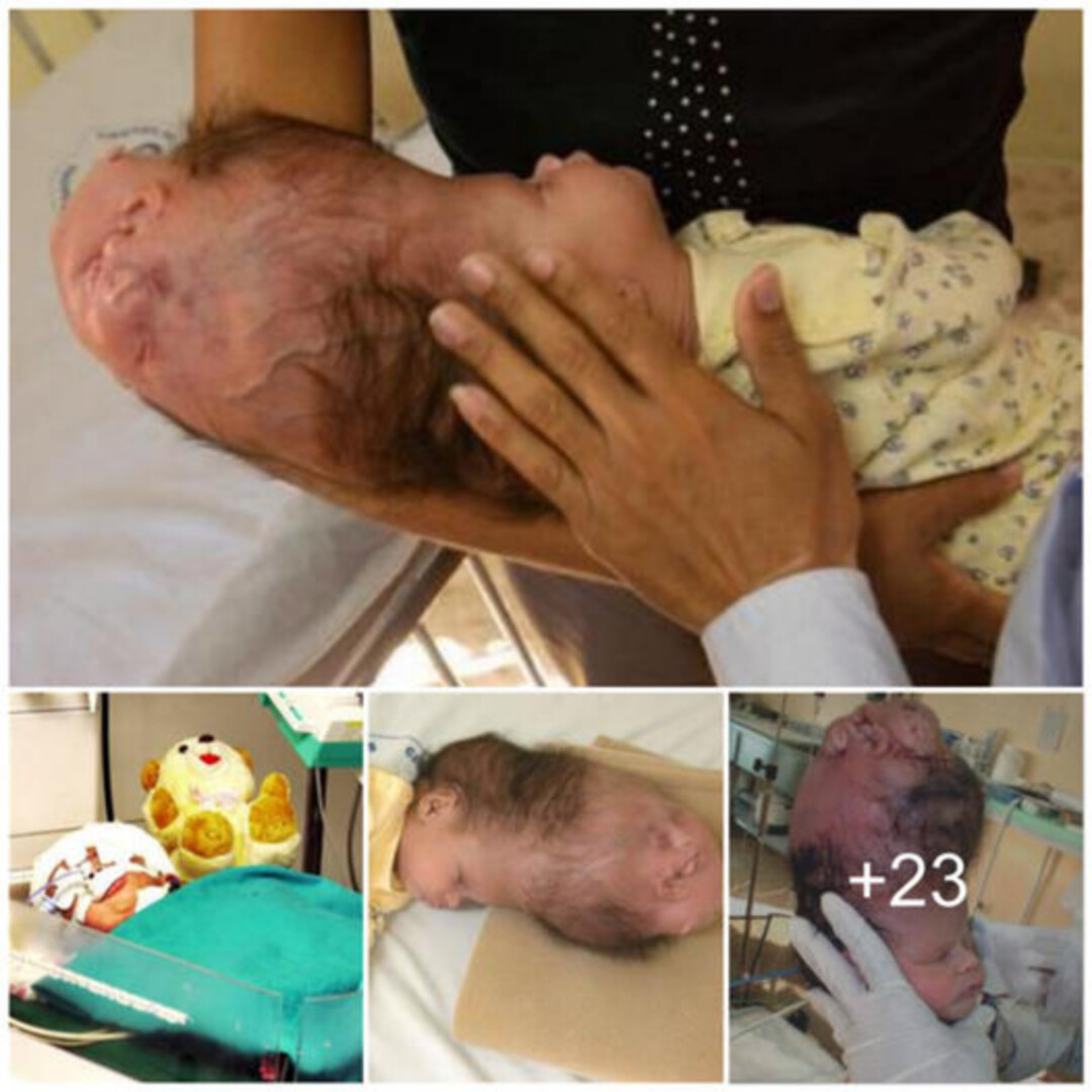 Revealing Wonder: The Incredible Journey of a Two-Headed Baby Amazes and Inspires ‎